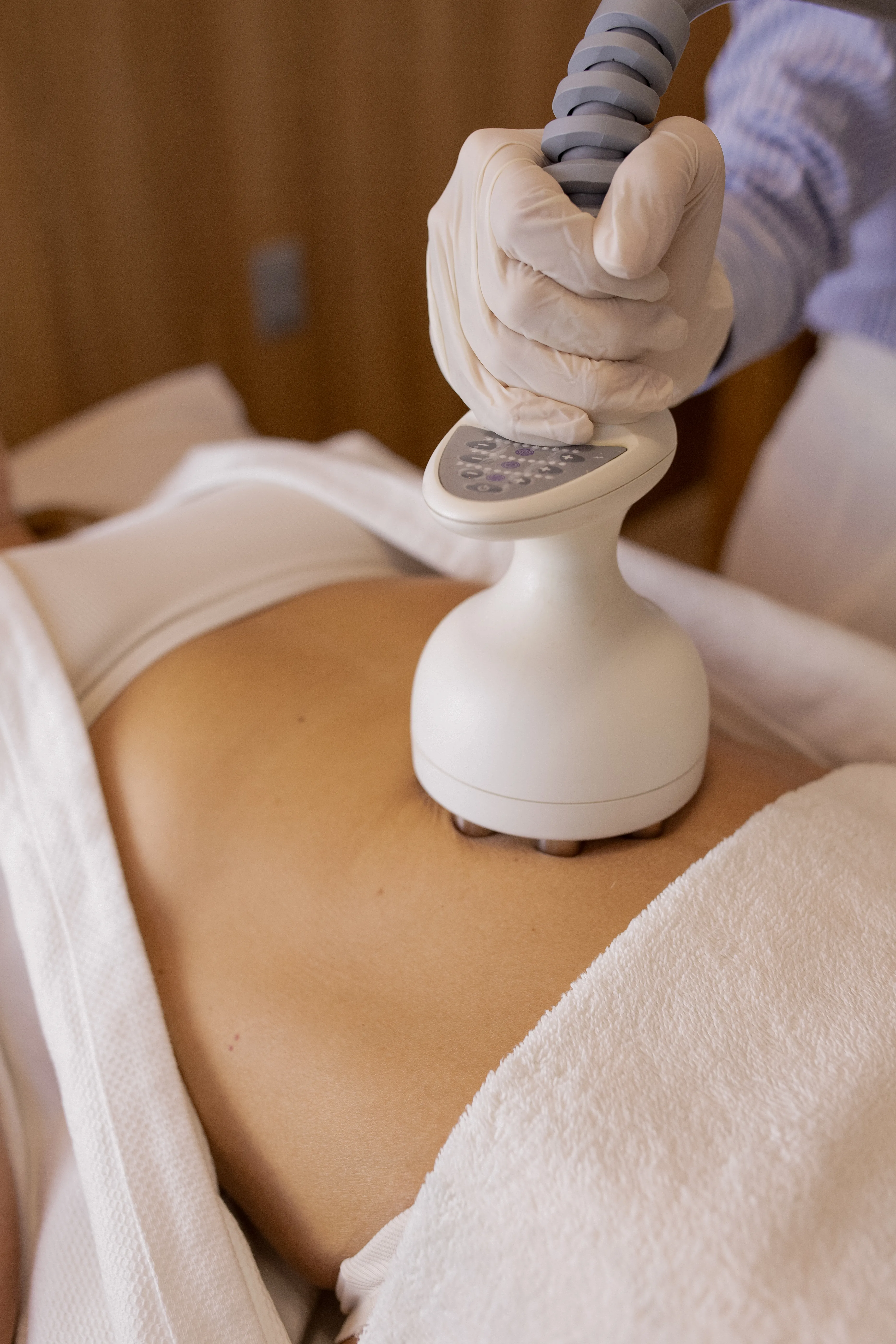 Tratamento para Gordura Localizada - Tratamento dermatológico para redução de gordura e remodelação corporal.